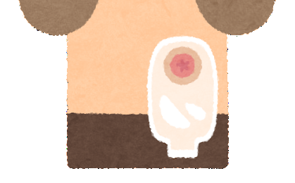 ストーマ装具を装着